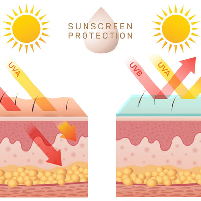 Electrologists as Educators: Sun Exposure Risks